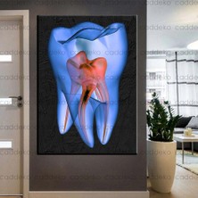 Caddeko Ağız ve Diş Sağlığı Polikliniği Tabloları Dekoratif Diş, Dekoratif Dişçi, Dişçi Dekorasyonu DSC-135
