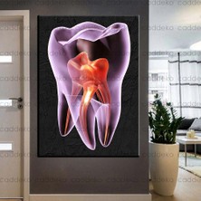 Caddeko Ağız ve Diş Sağlığı Polikliniği Tabloları Dekoratif Diş, Dekoratif Dişçi, Dişçi Dekorasyonu DSC-140