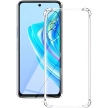 Caseart Infinix Hot 20 Kapak Kamera Korumalı Airbag Antishock Köşe Korumalı Şeffaf Silikon Kılıf