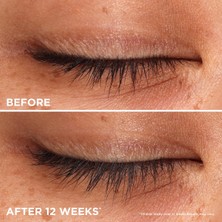 Benefıt Cosmetıcs Whoop Lash - Kirpik Canlandırıcı Serum 2 ml