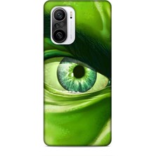 Lopard Xiaomi Redmi K40 Pro Kılıf Caliburn 29 Hulk Göz Makro Leke Tutmaz Kapak