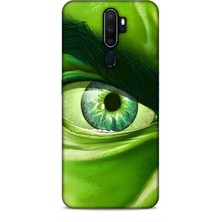 Lopard Oppo A9 2020 Kılıf Caliburn 29 Hulk Göz Makro Leke Tutmaz Kapak