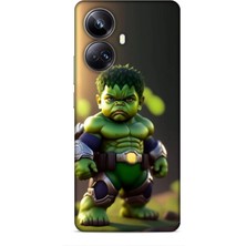 Lopard Realme 10 Pro Plus Kılıf Caliburn 24 Hulk Bebek Darbe Emici Kılıf