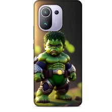 Lopard Xiaomi Mi 11 Pro Kılıf Caliburn 24 Hulk Bebek Darbe Emici Kılıf