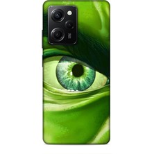 Lopard Xiaomi Poco X5 Pro 5g Kılıf Caliburn 29 Hulk Göz Makro Leke Tutmaz Kapak