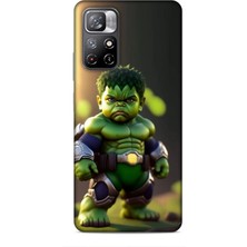 Lopard Xiaomi Poco M4 Pro 5g Kılıf Caliburn 24 Hulk Bebek Darbe Emici Kılıf