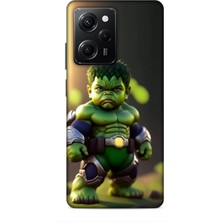 Lopard Xiaomi Poco X5 Pro 5g Kılıf Caliburn 24 Hulk Bebek Darbe Emici Kılıf