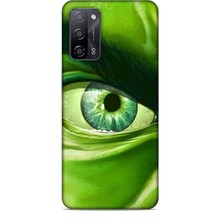 Lopard Oppo A55 5g Kılıf Caliburn 29 Hulk Göz Makro Leke Tutmaz Kapak