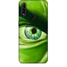 Lopard Oppo A31 Kılıf Caliburn 29 Hulk Göz Makro Leke Tutmaz Kapak