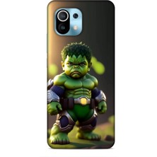 Lopard Xiaomi Mi 11 Kılıf Caliburn 24 Hulk Bebek Darbe Emici Kılıf