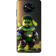 Lopard Xiaomi Poco X3 Pro Kılıf Caliburn 24 Hulk Bebek Darbe Emici Kılıf