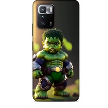 Lopard Xiaomi Poco X3 Gt Kılıf Caliburn 24 Hulk Bebek Darbe Emici Kılıf