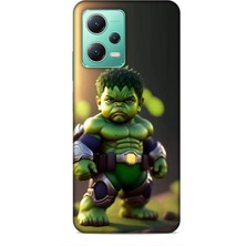 Lopard Xiaomi Poco X5 5g Kılıf Caliburn 24 Hulk Bebek Darbe Emici Kılıf