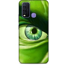 Lopard Vivo V29 Lite 5g Kılıf Caliburn 29 Hulk Göz Makro Leke Tutmaz Kapak