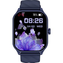 İXtech Xeefit-10 Akıllı Saat Amoled Ekran Sesli Asistan Konuşma Özellikli