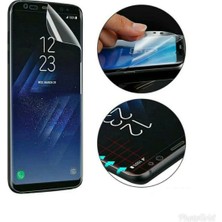 Carecase Care Case Honor 90 Için Özel Tpu Nano Ekran Koruyucu