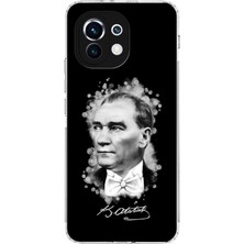 PrintiFy Xiaomi Mi 11 Kamera Korumalı Kapak Atatürk Tasarımlı Şeffaf Kılıf