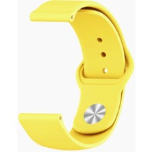 Teleplus General Mobile Gm Watch Klasik Kordon KRD11 22MM