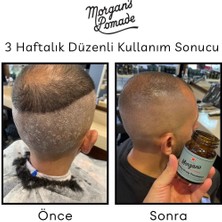 Morgan's Pomade Cooling Scalp Treatment - Egzama Kepek Karşıtı Baş Derisi Bakım Tedavisi 100 gr