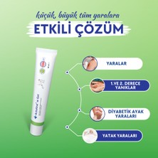 Actolind 50 ml Jel ve 50 ml Solüsyon | 2' Li Yara Bakım Seti