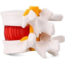 GongtuShop Insan Lomber Omurlararası Disk Fıtığı Gösteri Modelinin Lomber Vertebral Modeli (Yurt Dışından)