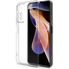 Nettech Xiaomi Redmi Note 11 Pro Uyumlu Tıpalı Şeffaf Seri Arka Koruma Kılıf