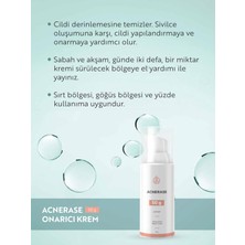 Alpinia Acnerase 50g Onarıcı Krem