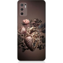 Teknomeg Xiaomi Redmi Note 10 5g Uyumlu Kalp ve Gül Desenli Silikon Kılıf