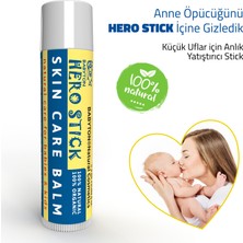 Babyton Anlık Yatıştırıcı Doğal Hero Stick