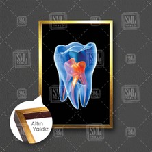 SML Tablo Diş Hekimi Ofisi Kanal Sinirler Dişçi Dentist Çerçeveli Dikey Kanvas Tablo