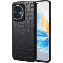 Xshine Honor 100 5g Pu Deri Kaplamalı Pc+Tpu Timsah Doku Telefon Koruyucu Kapak (Yurt Dışından)