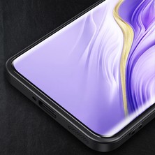 Xshine Honor Magic6 5g Ince Kılıf Tpu + Alüminyum Alaşımlı Koruyucu Telefon Kapağı (Yurt Dışından)