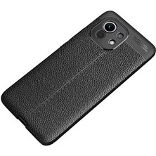 Kilifolsun - Xiaomi Mi 11 Uyumlu Kılıf Deri Görünümlü Auto Focus Karbon Niss Silikon Kapak