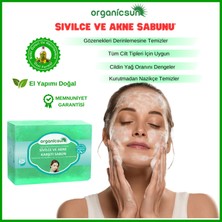 Organicsun Doğal Akne Ve Sivilce Karşıtı Sabun 140 Gr Tüm Cilt Tipleri Için Natural Sabun