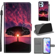 Gx Shop Onur X7A Davası ile Uyumlu (Yurt Dışından)
