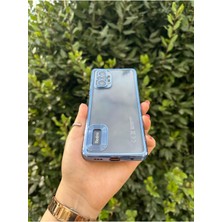 Vip Case Xiaomi Redmi Note 10 / 10S Uyumlu Logo Detaylı Kenarları Renkli Kamera Korumalı Luxury Omega Kılıf