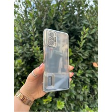 Vip Case Xiaomi Redmi Note 10 / 10S Uyumlu Logo Detaylı Kenarları Renkli Kamera Korumalı Luxury Omega Kılıf