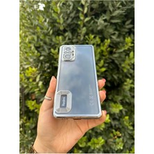 Vip Case Xiaomi Redmi Note 10 / 10S Uyumlu Logo Detaylı Kenarları Renkli Kamera Korumalı Luxury Omega Kılıf