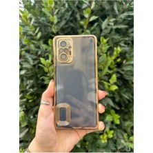 Vip Case Xiaomi Redmi Note 10 / 10S Uyumlu Logo Detaylı Kenarları Renkli Kamera Korumalı Luxury Omega Kılıf