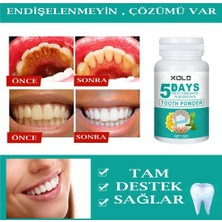 Xolo Diş Beyazlatma Tozu Aktif Karbon 50 gr Tooth Powder 5 Days Usa