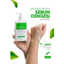 Docteur Blanc Akne Önleyici Vücut Losyonu Yağlı Ve Akneye Eğilimli Ciltler Için 250 ml