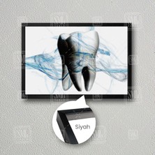 SML Tablo Diş Hekimi Odası Büro Diş Ağız Sağlığı Dekor Çerçeveli Yatay Kanvas Tablo