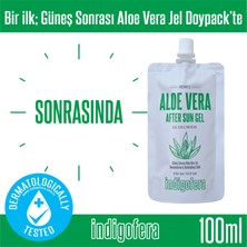 İndigofera Aloe Vera Jel