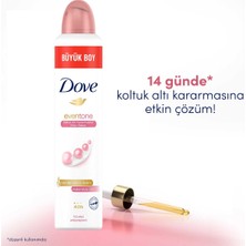 Dove Kadın Sprey Deodorant Eventone Kalendula Özü Büyük Boy 200 ml x1 Adet