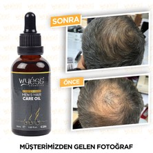 Professional Wyess Erkekler Özel Saç Bakım Yağı Yeni Saç Teli Çıkaran E Vitaminli 30 Yağ 50 ml