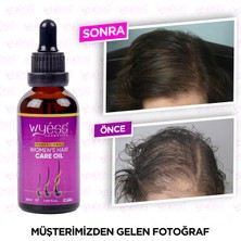 Professional Wyess Kadınlara Özel Saç Bakım Yağı Yeni Saç Teli Çıkaran Kenevir Yağı 50 ml