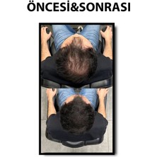 Batçı Hair Ateliler Saç Kapatıcı Dolgunlaştırıcı Sıvı Krem 30 ml 08684172952415, One Size