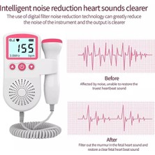 Fetal Doppler Jsl- T501 3 Mhz Hamile / Bebek Kalp Atışı Ölçme