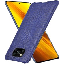 Mays Shop Şık Klasik Durumda Xiaomi Poco X3 Nfc Klasik Timsah Moda Anti (Yurt Dışından)