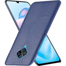 YH Market Vivo S1 Pro Koruyucu Kapak Uyumluluğu Için Şık Klasik Kılıf Anti (Yurt Dışından)